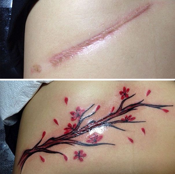 tattoo ideas to cover scars